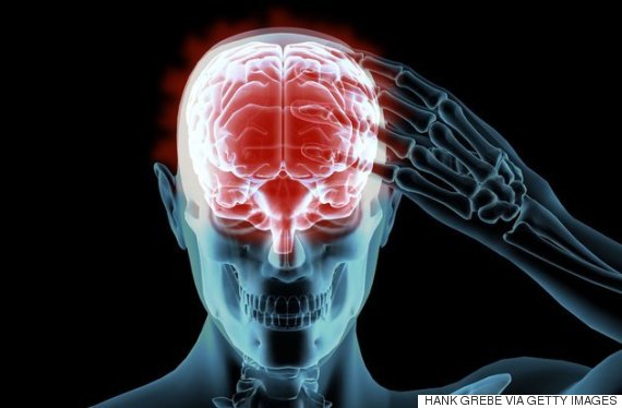 ã¢ã«ããã¤ãã¼ì ëí ì´ë¯¸ì§ ê²ìê²°ê³¼