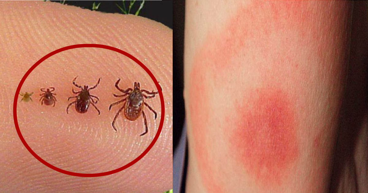 The Dangers Of Ticks And How To Properly Remove Them - Small Joys