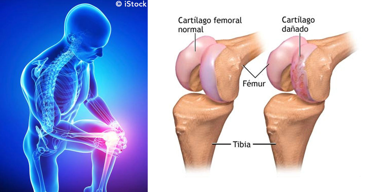 Que puedo tomar para dolor de rodilla