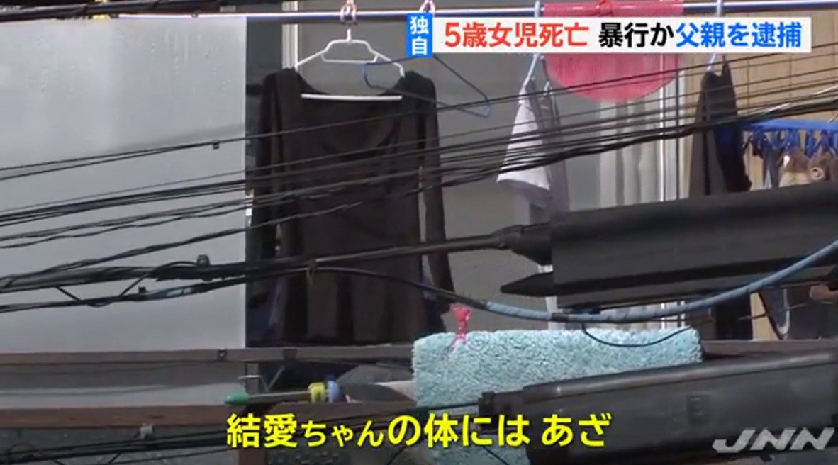 ãçµæã¡ããã両親ãã®ç»åæ¤ç´¢çµæ