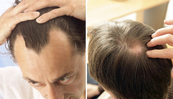 ì¸ì¬ì´í¸ í모ì ëí ì´ë¯¸ì§ ê²ìê²°ê³¼