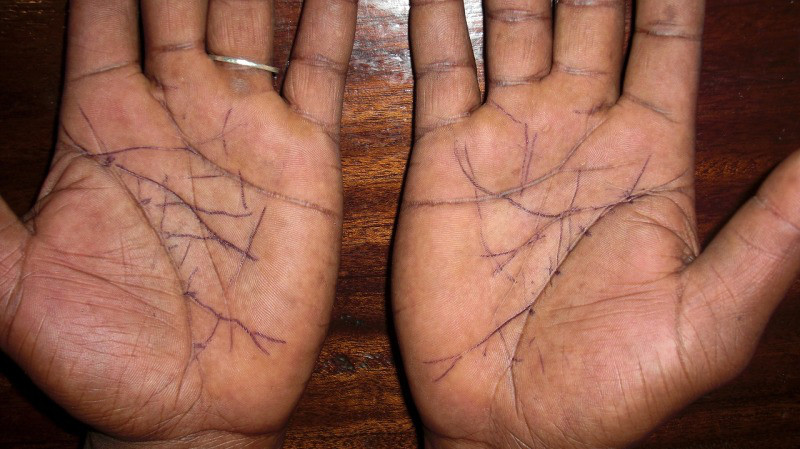 Image result for æç¸ãæ¿ã ç·æ§