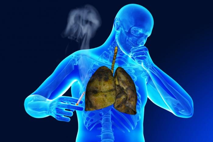 Image result for Respiratory Diseases