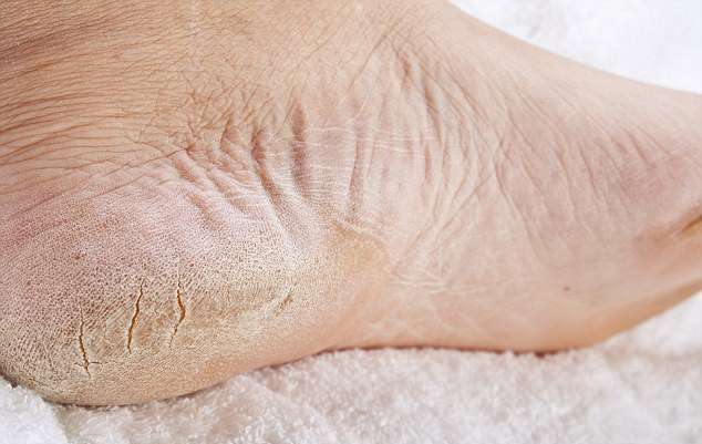 feet-3