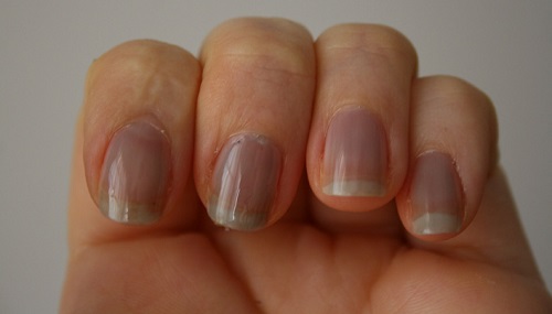 how-your-fingernails-might-indicate-something-is-wrong-with-your-health