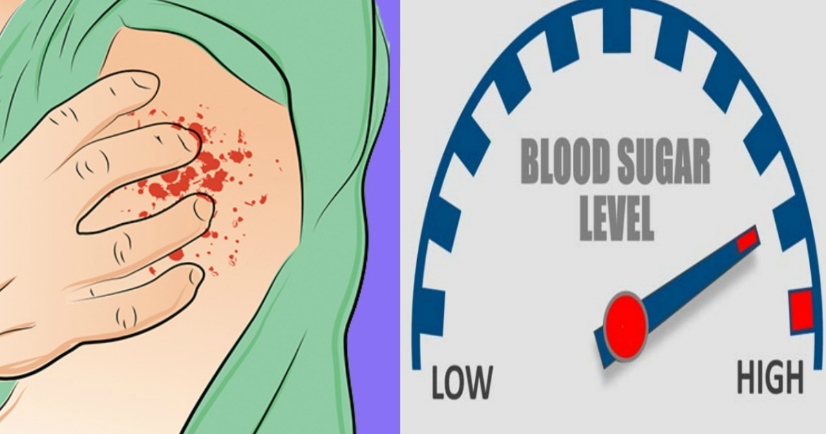 16 Symptoms That Indicate Your Blood Sugar Level Is Too High Small Joys