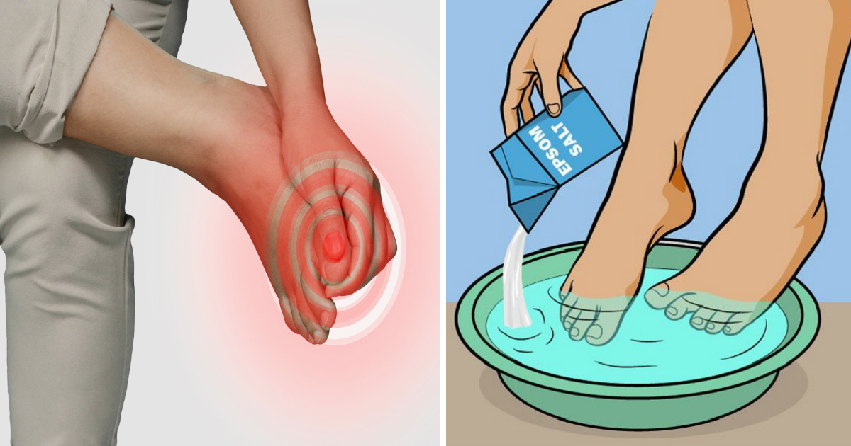 Steps on How to Get Rid of an Ingrown Toenail without Surgery- DIY