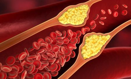 åèç¡¬åì ëí ì´ë¯¸ì§ ê²ìê²°ê³¼