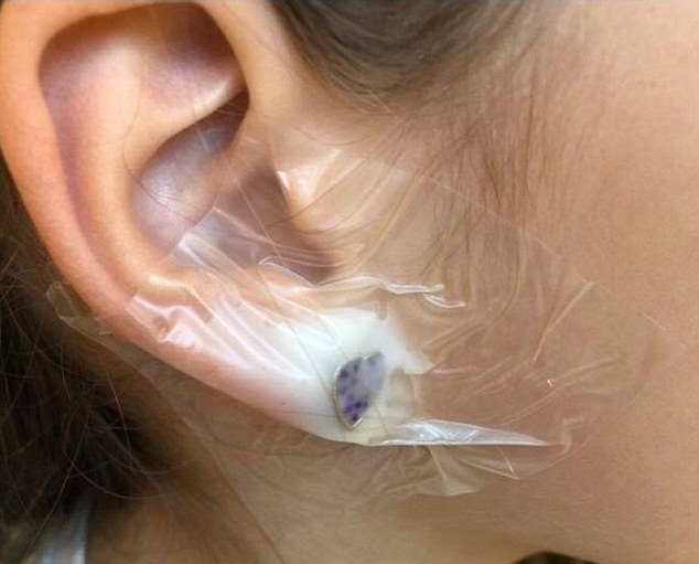 Mother Outraged As 7 Year Old Daughter Was Hospitalized After Getting Ears Pierced Small Joys