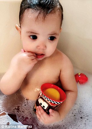 Due to her rare condition, Mehlani has only the sliver of an iris in her left eye, and none at all in her right eye