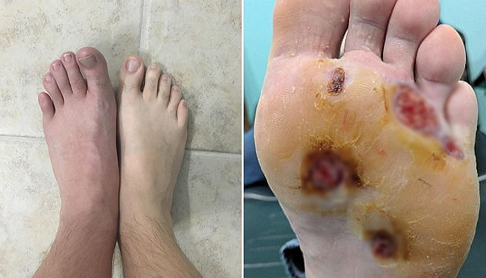 ì¸ì¬ì´í¸