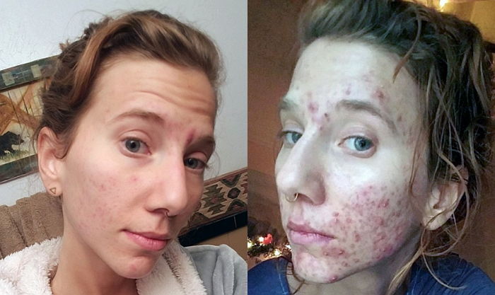 ì¸ì¬ì´í¸