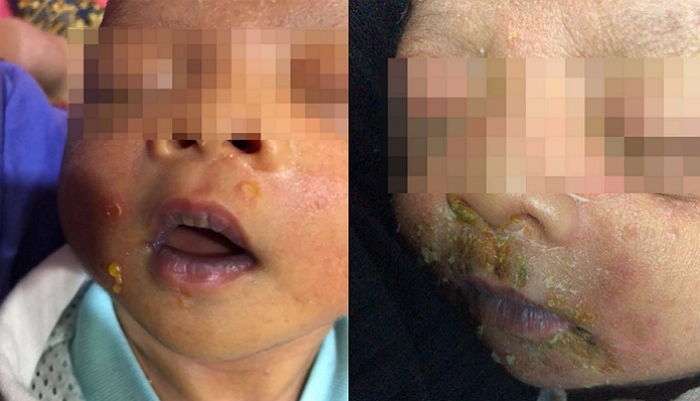 ì¸ì¬ì´í¸