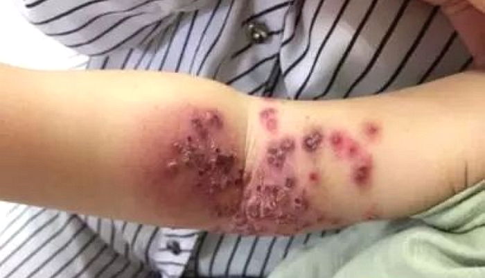 ì¸ì¬ì´í¸