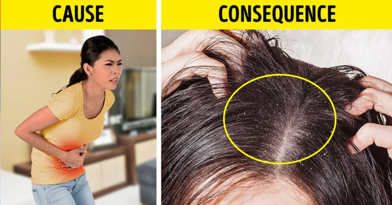 hahaha 768x403.jpg - 5 Things Your Hair Is Desperately Trying To Tell About Your Health