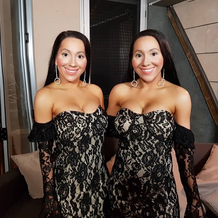 Worlds ‘most Identical Twins Spent 250k On Plastic Surgeries To Look Even More Alike Small Joys 