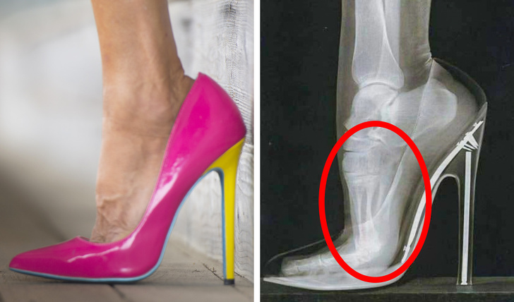 6 Types of Shoes That Can Do Too Much Damage to Your Body