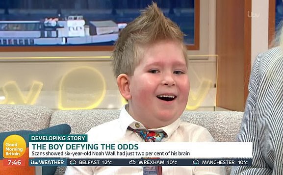 6-Year-Old Boy Defies All Odds After Being Born With No Brain - Small Joys