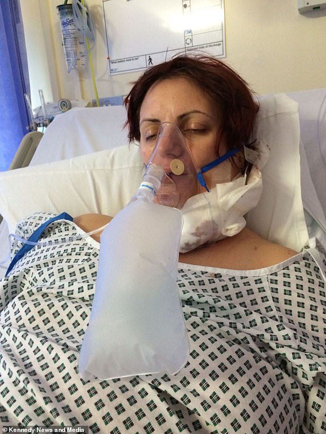 Mrs Smith had two operations to remove her full outer and inner ear, lymph nodes, tragus, salivary glands and temporal bone