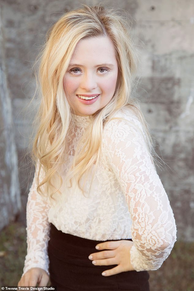 Stunning: Her parents, Linda and Jeff Strobel, were told by a counselor when Grace was born that their daughter would face a lifetime of challenges as a result