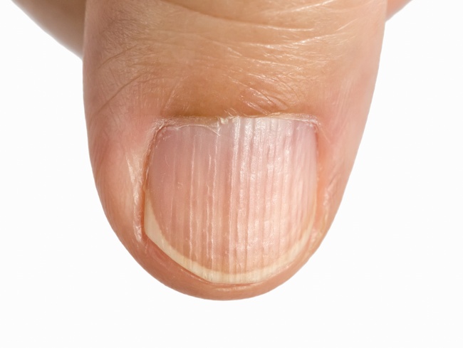 8 Signs You Might Have a Protein Deficiency