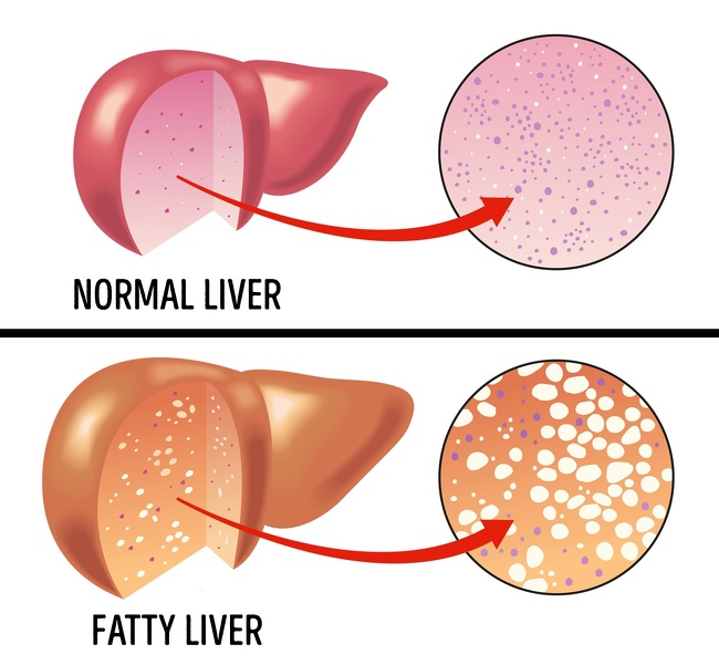 8 Signs You Might Have a Protein Deficiency
