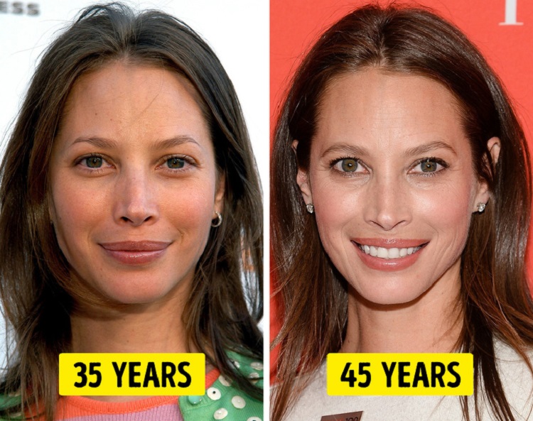 Развитие в 35 лет. Морщины в 35 лет фото. 30 Лет лицо. Морщины в 30 лет фото. Возрастная кожа лица.