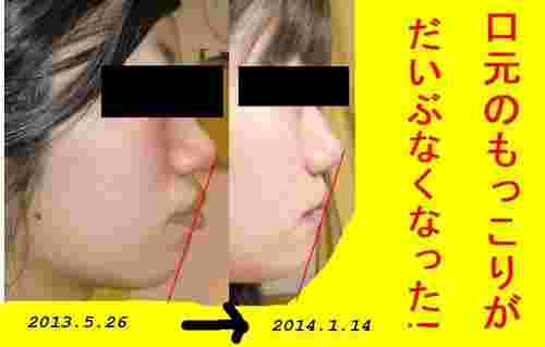驚き 口を閉じるだけで 鼻呼吸 の効果が凄い Hachibachi
