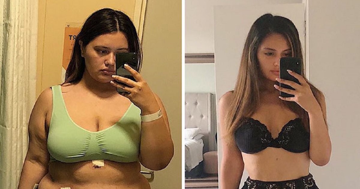 Woman's Incredible Before-And-After Pictures Of Her 141-Pound Weig...