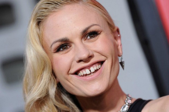 defecto de las famosas