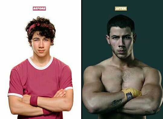 Resultado de imagen de nick jonas before after