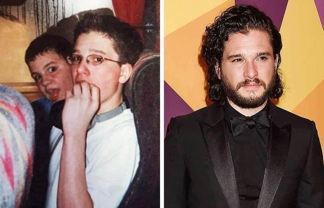 14 Celebridades que solían ser ñoños de jóvenes