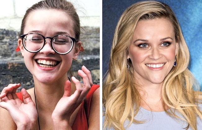 14 Celebridades que solían ser ñoños de jóvenes