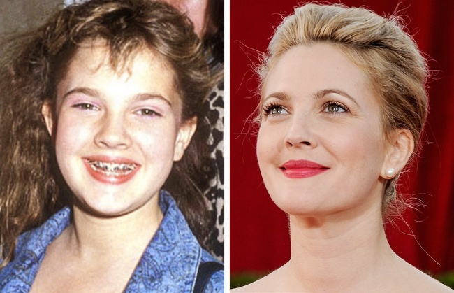 14 Celebridades que solían ser ñoños de jóvenes