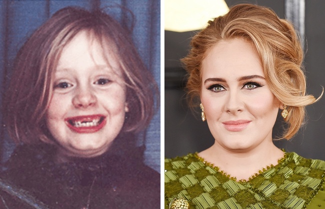 14 Celebridades que solían ser ñoños de jóvenes