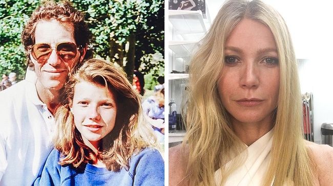 14 Celebridades que solían ser ñoños de jóvenes