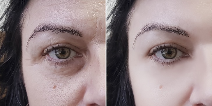 14 Remédios caseiros fáceis para ter uma pele mais fresca e radiante