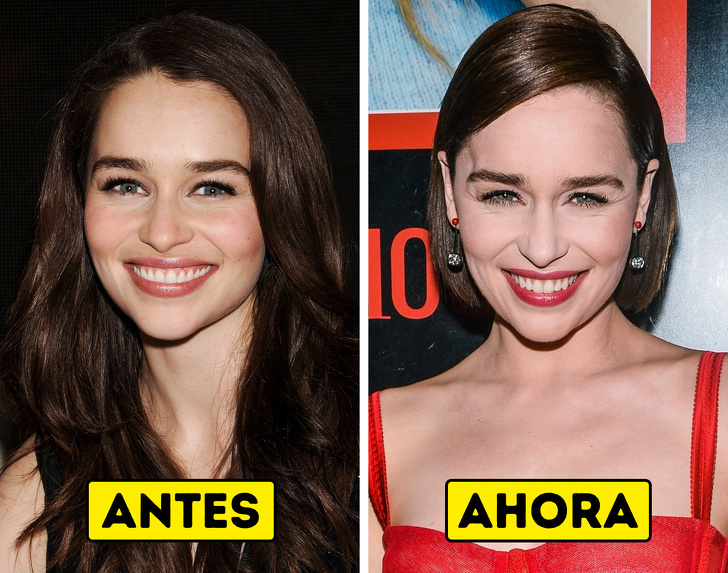 15 Celebridades que de repente cambiaron su apariencia y ahora apenas logramos reconocerlos