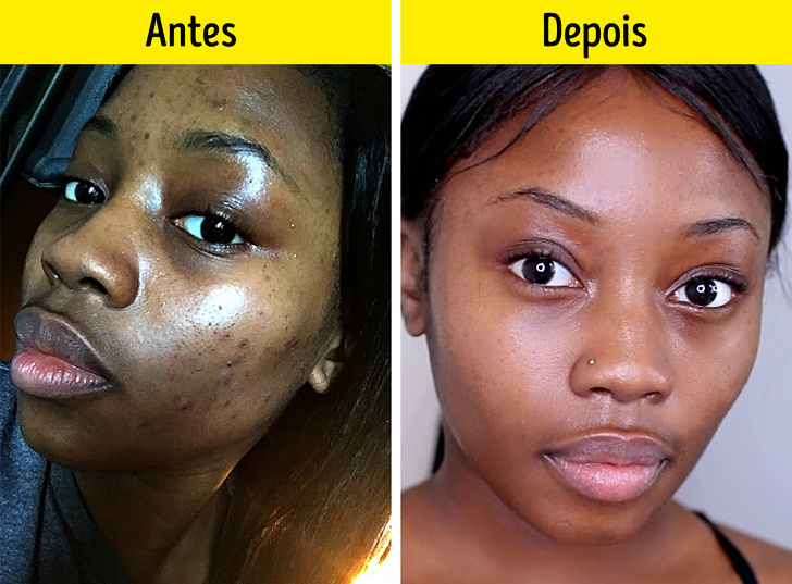 20+ Óleos para cabelos, pele e unhas melhores que qualquer cosmético