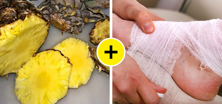 10 Maneras rápidas para deshacerte de los callos y hacer que tus pies sean suaves como los de un bebé