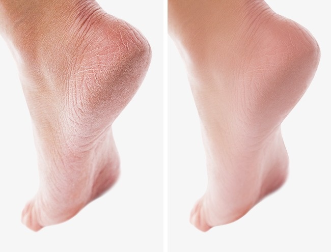 15 Trucos de belleza que desearías haber conocido antes