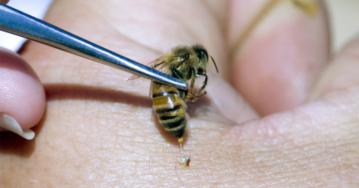 La thérapie par piqûres d'abeille peut guérir plusieurs maladies Vonjour