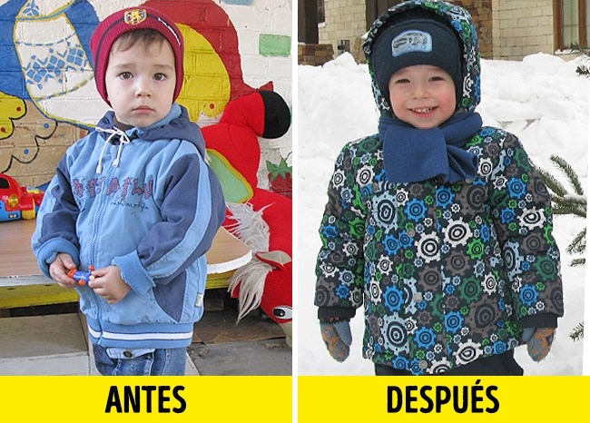 12 Fotos de crianças antes e depois de serem adotadas