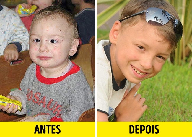 12 Fotos de crianças antes e depois de serem adotadas
