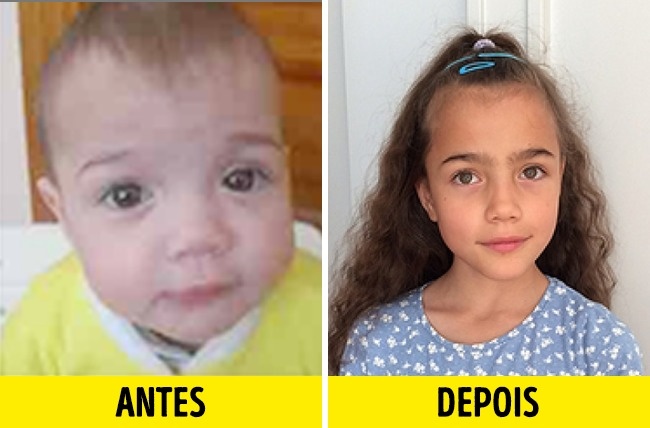 12 Fotos de crianças antes e depois de serem adotadas