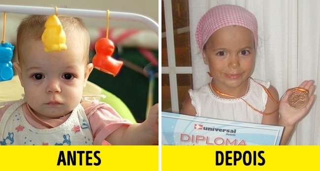 12 Fotos de crianças antes e depois de serem adotadas