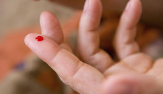 Resultado de imagen de CoagulaciÃ³n sanguÃ­nea excesiva