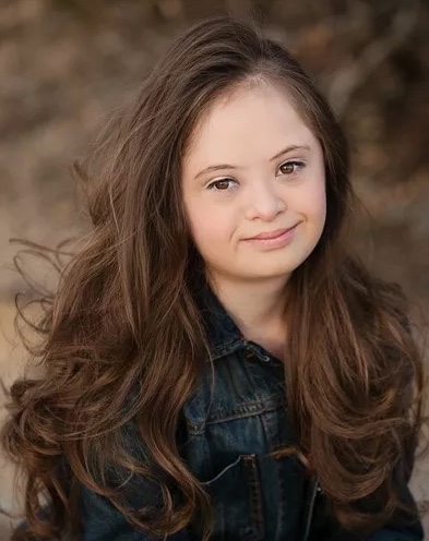 30 Beautiful Models With Down Syndrome - Small Joys