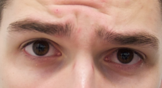 eyebrows