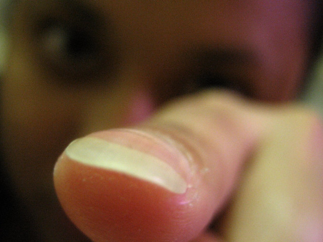 finger